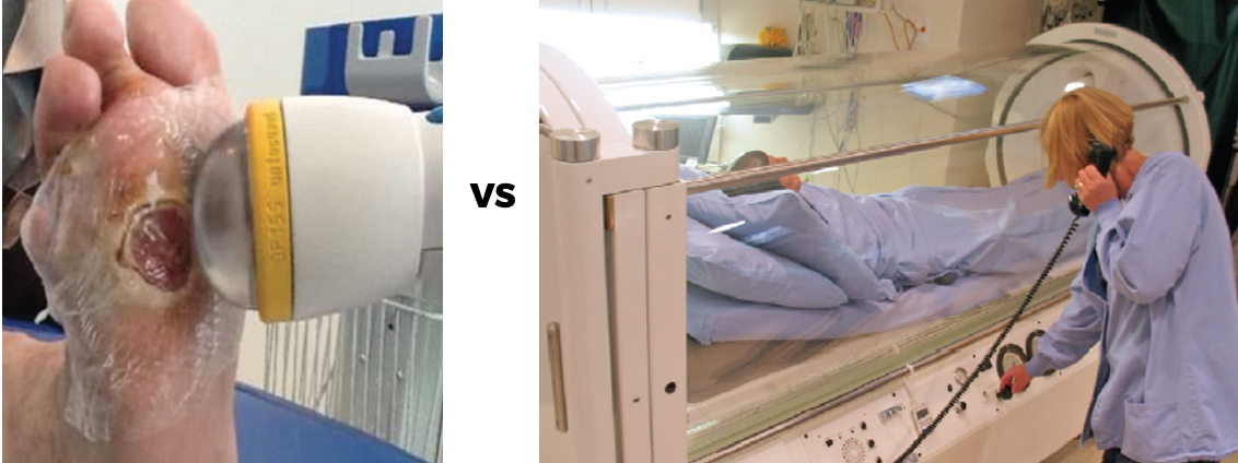 softwave vs hyperbaric