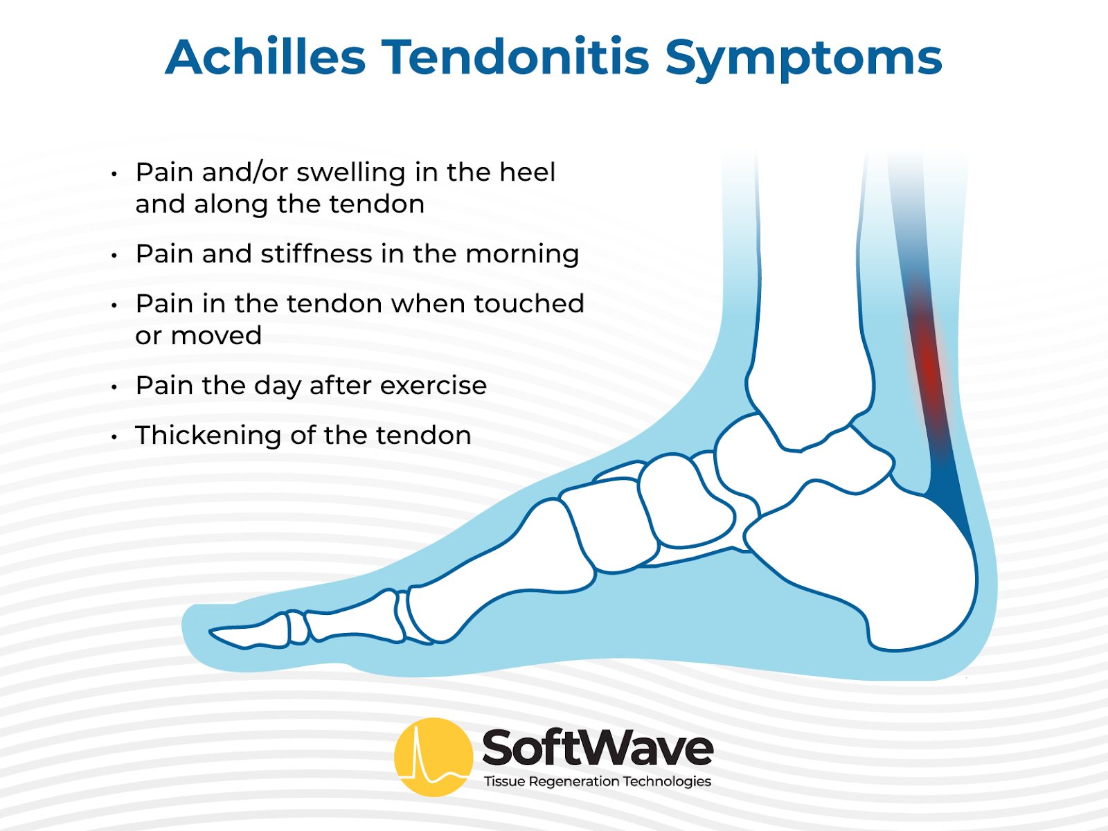 Achilles tendon sore in morning hotsell