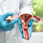 Effective Medical Devices for Treating Uterine Fibroids