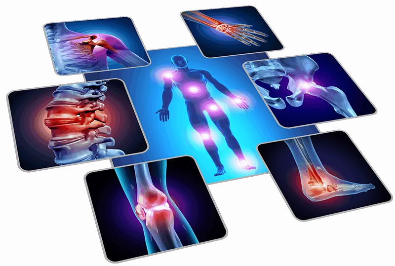 skeleton-with-pain-points-scaled4