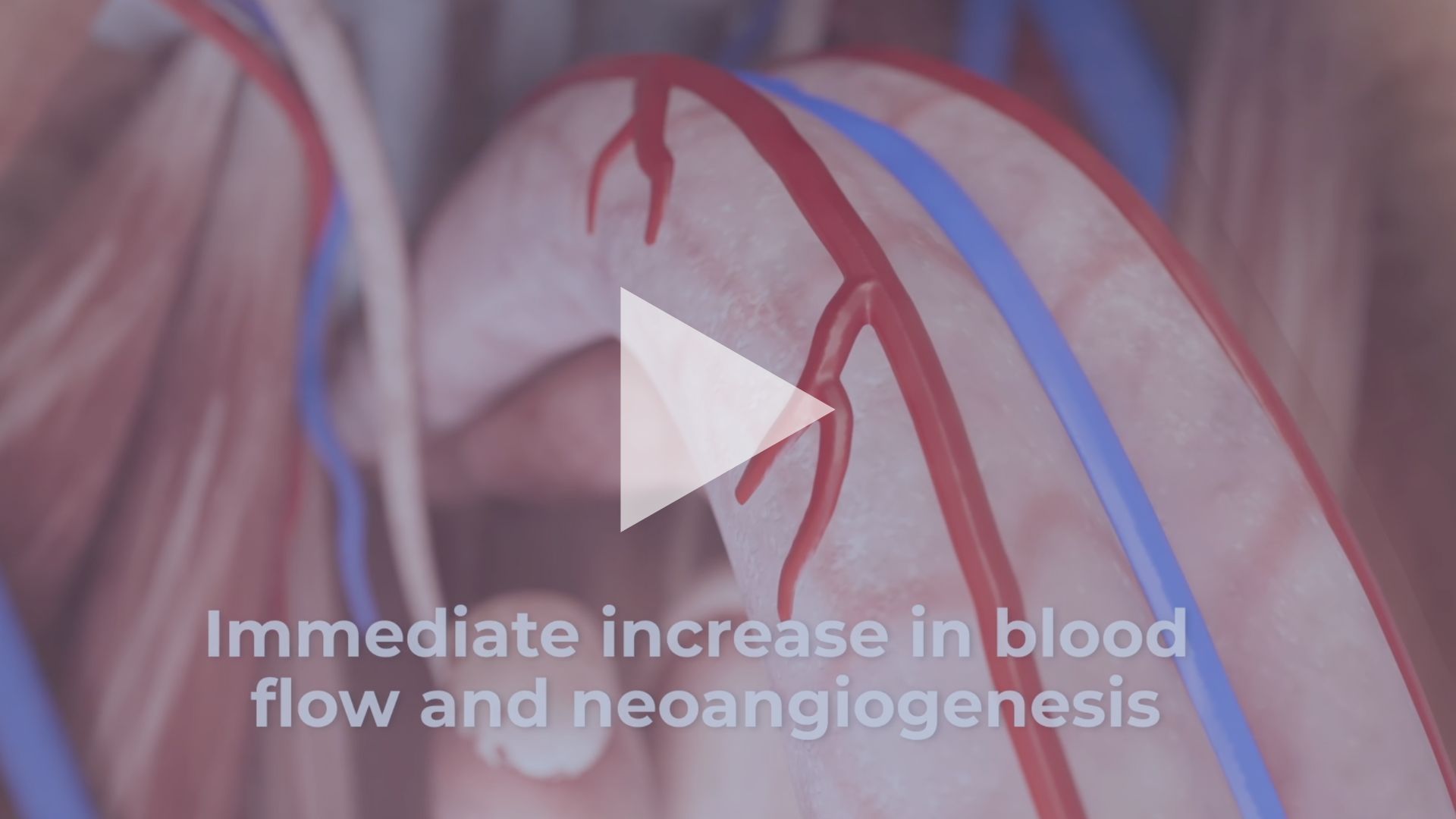 Immediate increase in blood flow neoangiogenesis