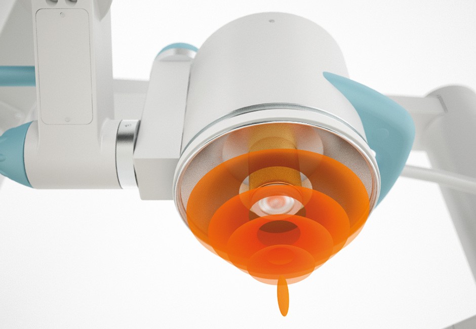 Storz Modulith Shockwave Systems- Mechanisms, Clinical Context, & Alternatives