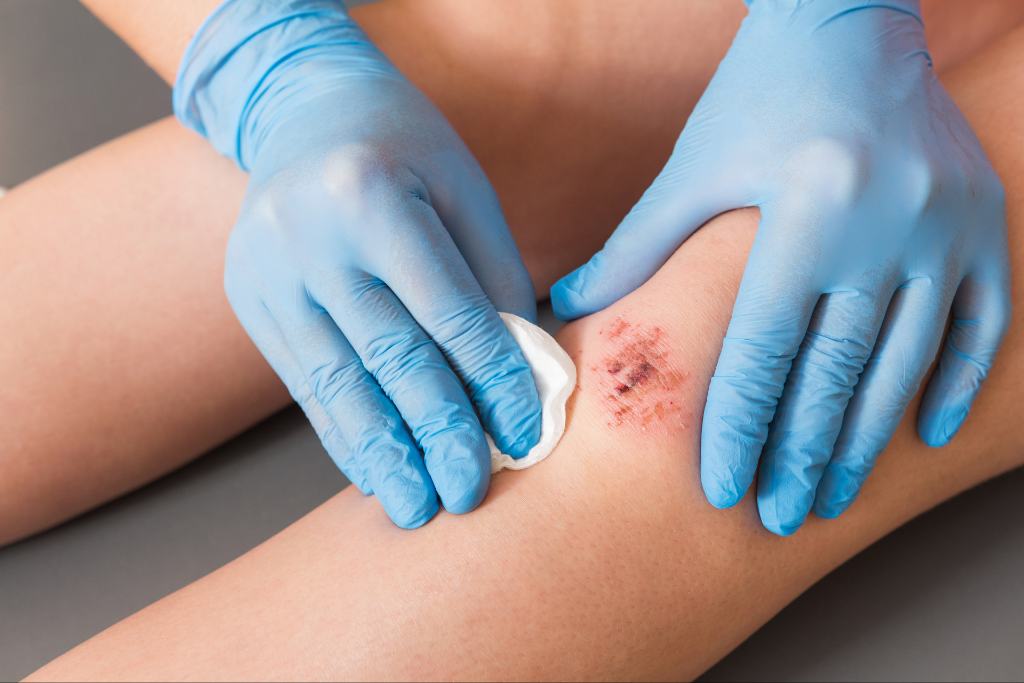 Provider’s Guide to Shockwave Therapy for Wound Care Provider’s Guide to Shockwave Therapy for Wound Care